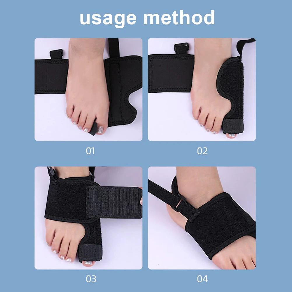 Hallux Valgus Zehenspreizer – Verstellbarer Zehenrichter & Orthopädische Schiene