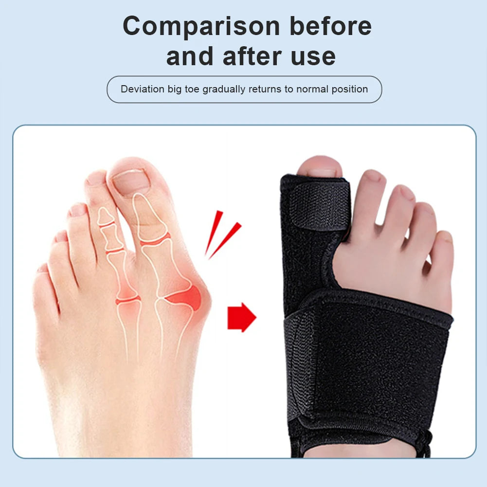 Hallux Valgus Zehenspreizer – Verstellbarer Zehenrichter & Orthopädische Schiene